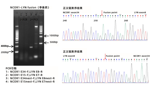 4. PCR+一代测序