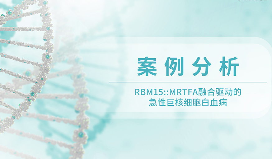 案例分析丨RBM15::MRTFA融合驱动的急性巨核细胞白血病