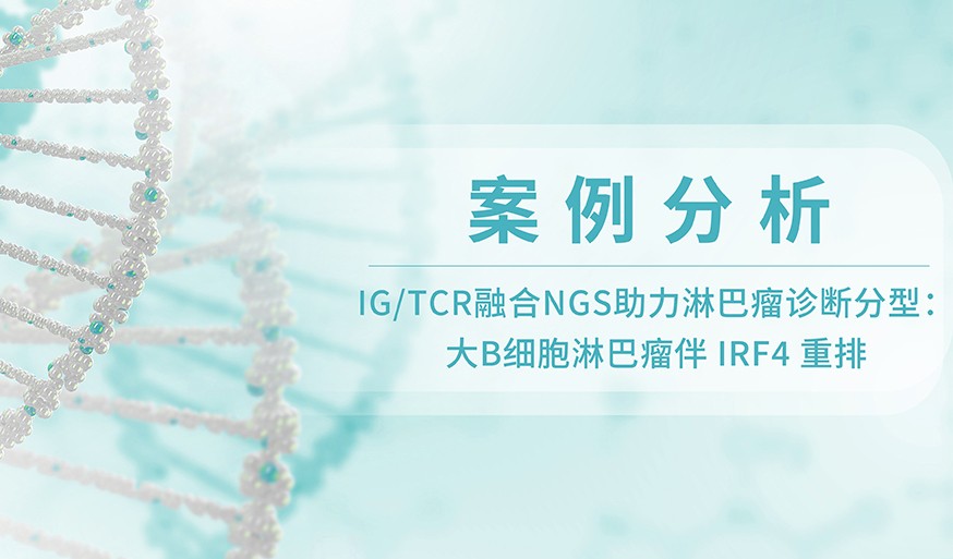 案例分析 | IG/TCR融合NGS助力淋巴瘤诊断分型：大B细胞淋巴瘤伴 IRF4 重排