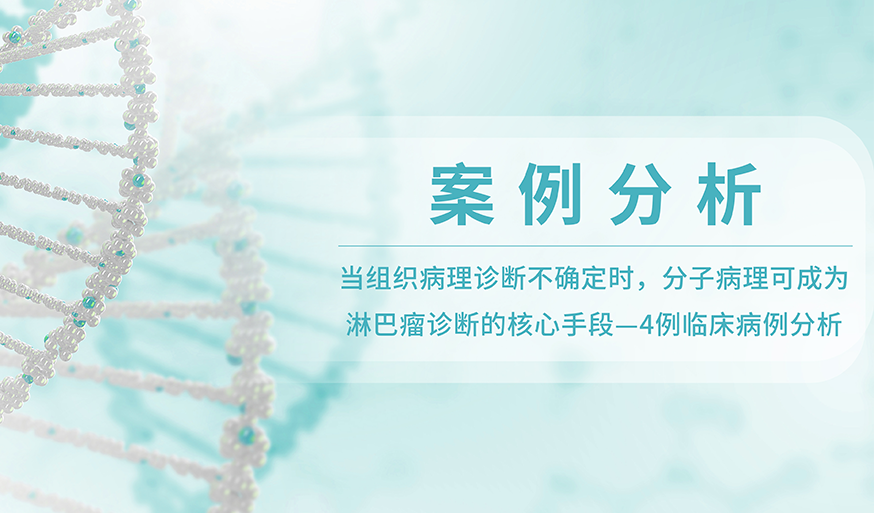 案例分析丨当组织病理诊断不确定时，分子病理可成为淋巴瘤诊断的核心手段—4例临床病例分析