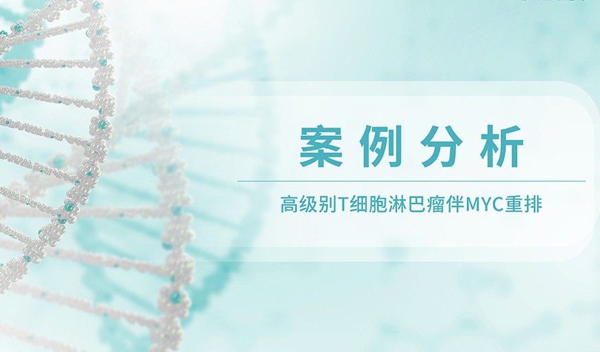 案例分析丨高级别T细胞淋巴瘤伴MYC重排